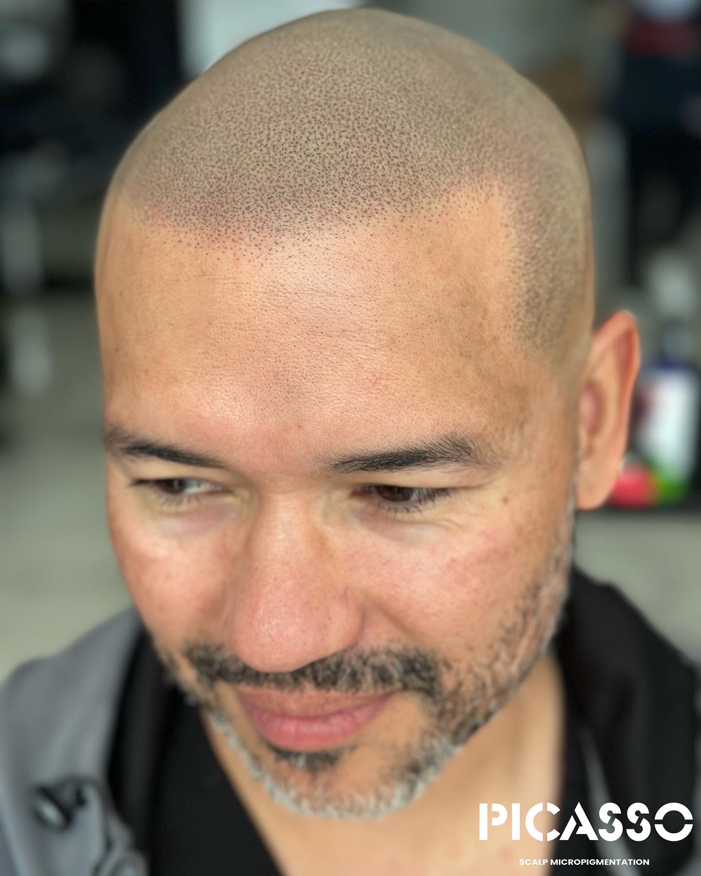 Scalp Micropigmentation Artist