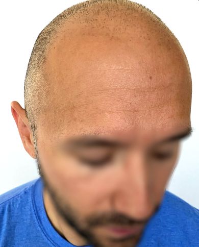 63