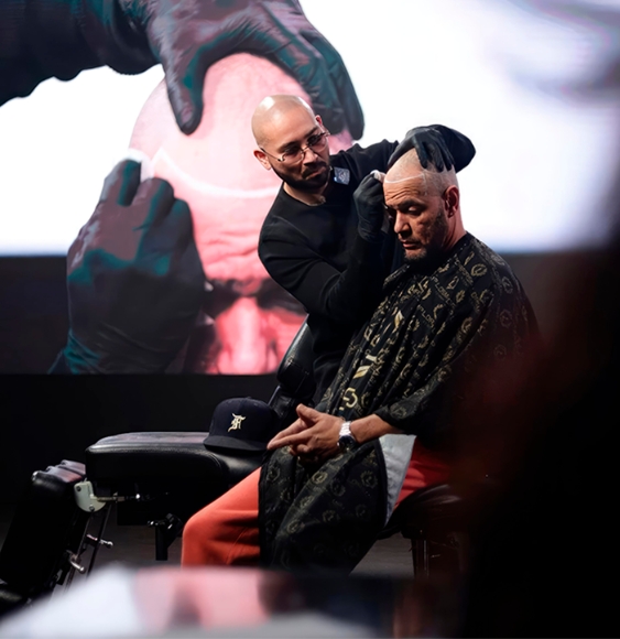 Scalp Micropigmentation Experts in California