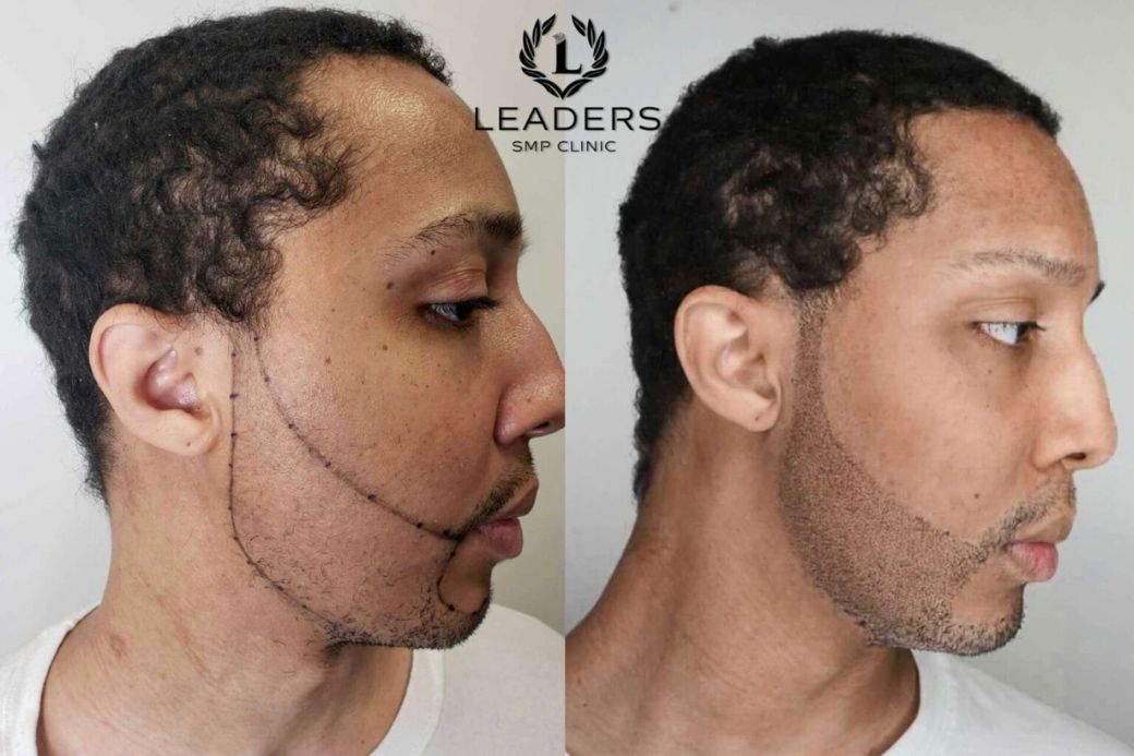 picassojeff.comconsultationBEARD ENHANCEMENT